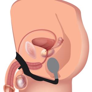 10X P-Bomb Silicone Cock And Ball Ring With Vibrating Anal Plug